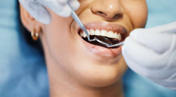 Best Emergency Tooth Extraction  in Goodview, MN