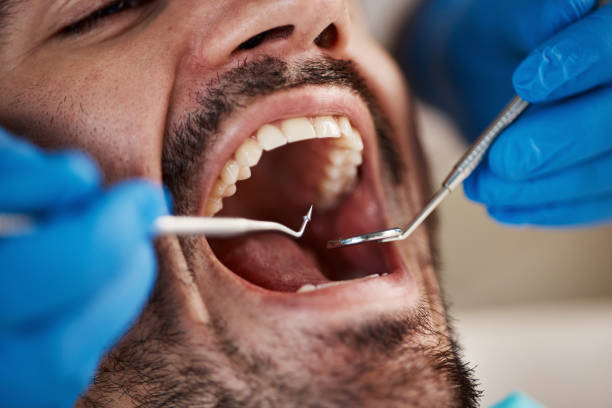 Best Chipped Tooth Repair Near Me  in Goodview, MN